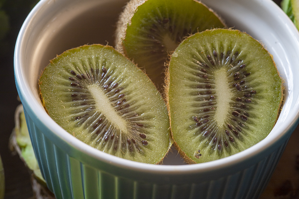 Everything You Wanted To Know About The Kiwi!